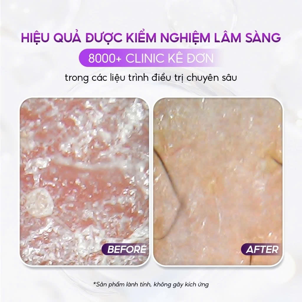 CONAPIDIL LOTION POLISHING: Dầu Rửa Mặt Sạch Sâu & Kháng Khuẩn, Dịu Nhẹ Cho Mọi Làn Da