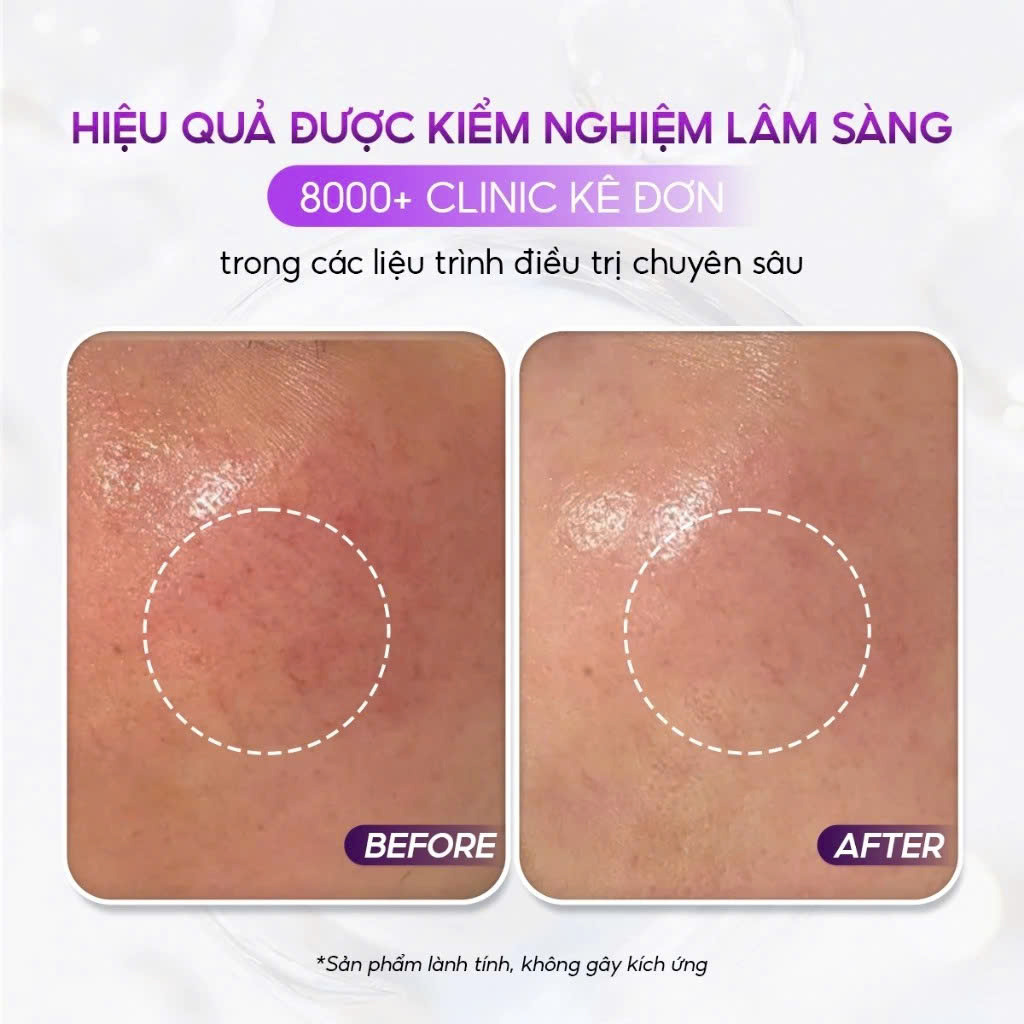 CONAPIDIL CEMENPHALT: Mặt Nạ Thạch Phục Hồi, Giúp Làn Da Nhạy Cảm Trở Nên Khỏe Mạnh