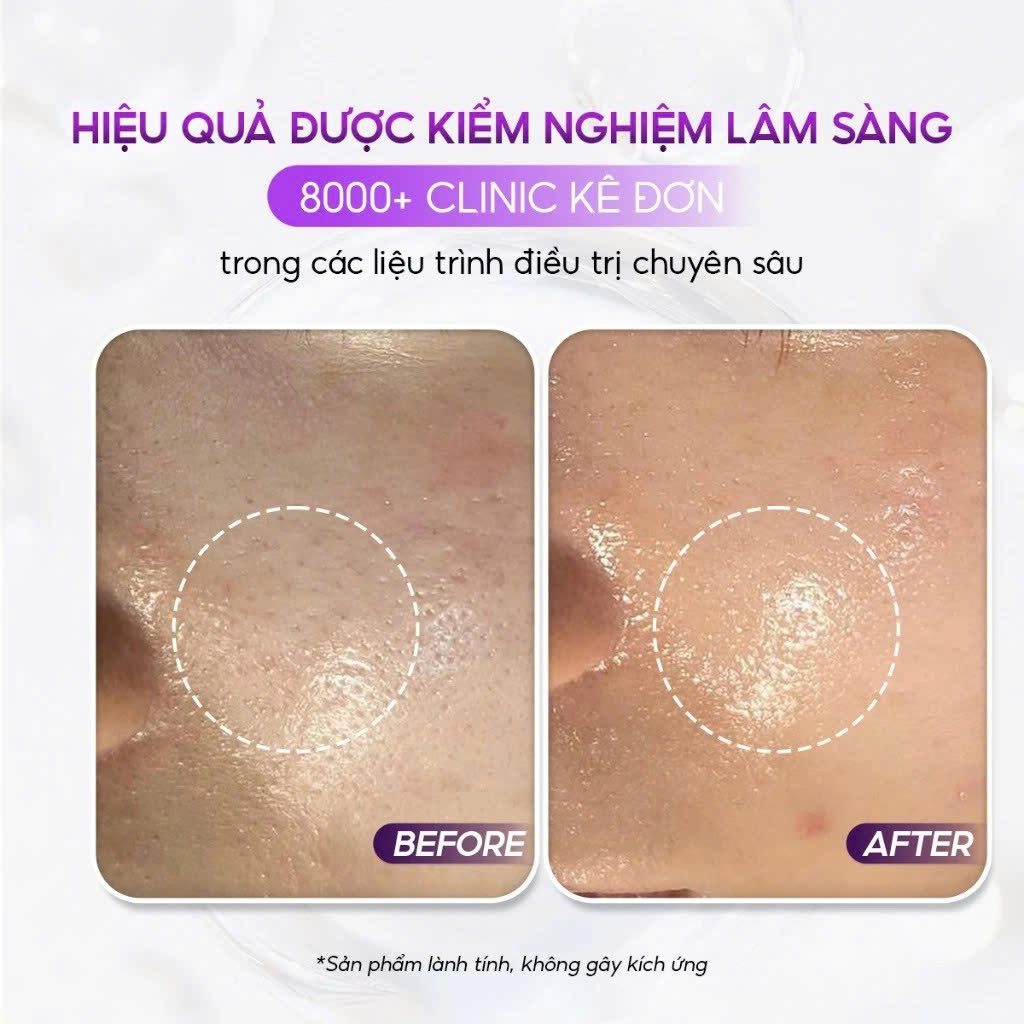 CONAPIDIL CEMENPHALT: Mặt Nạ Thạch Phục Hồi, Giúp Làn Da Nhạy Cảm Trở Nên Khỏe Mạnh