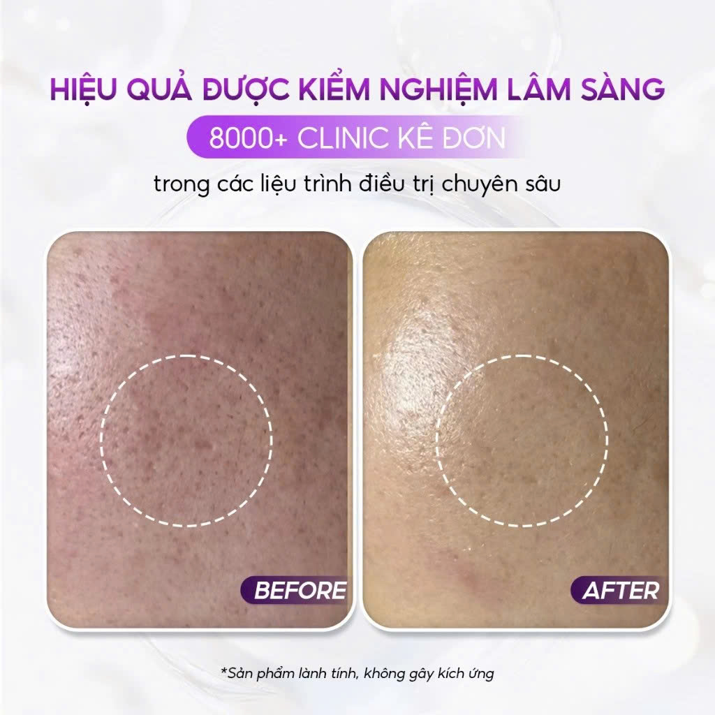 CONAPIDIL CEMENSHEET: Mặt Nạ Thải Độc & Phục Hồi - Cho Làn Da Khỏe Mạnh & Tươi Sáng