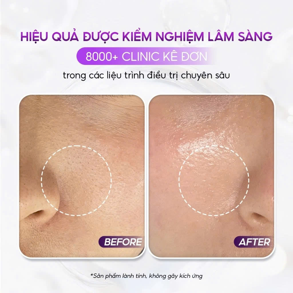 CONAPIDIL CEMENSHEET: Mặt Nạ Thải Độc & Phục Hồi - Cho Làn Da Khỏe Mạnh & Tươi Sáng