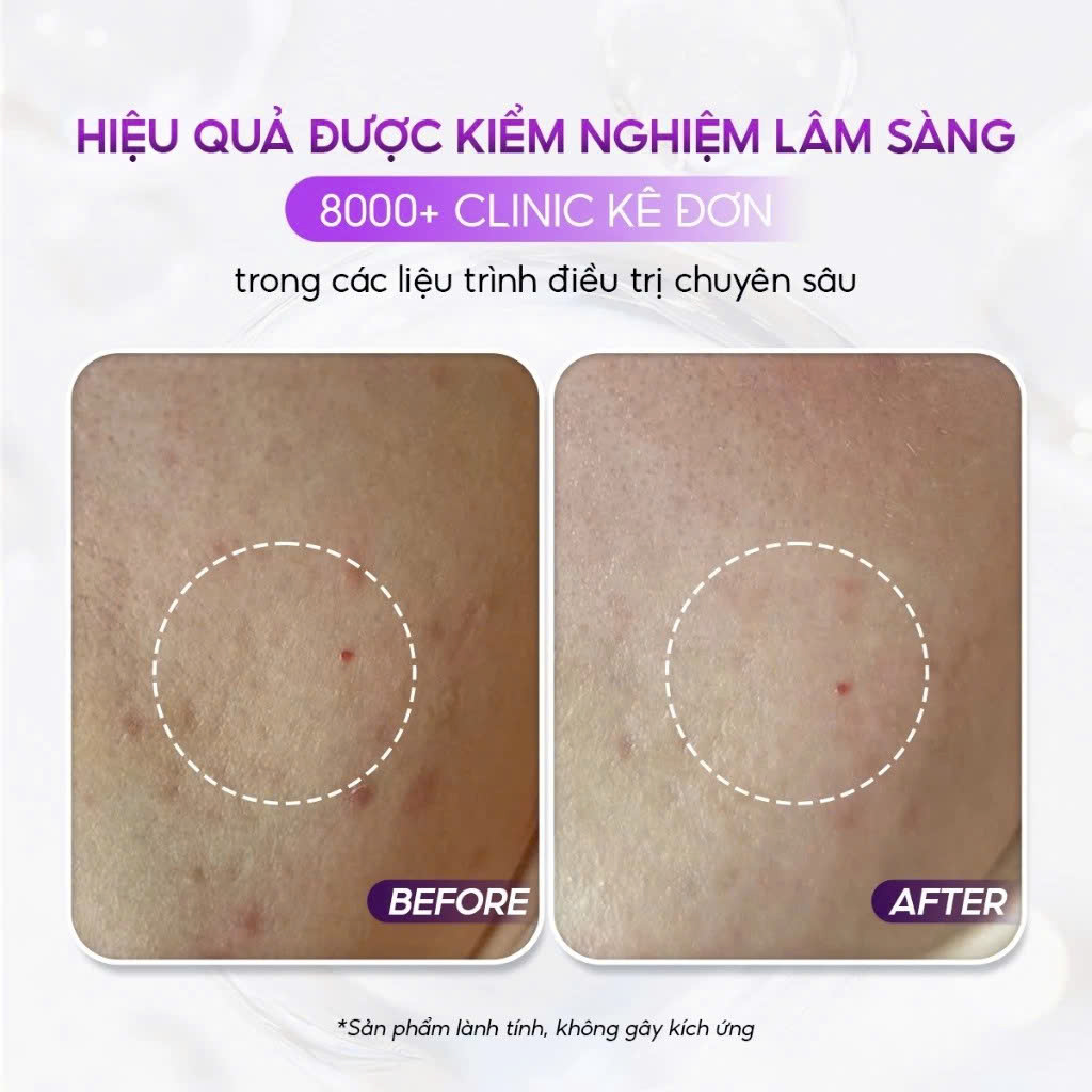 CONAPIDIL FINAL BALM: Kem Đa Năng "Lá Chắn" Bảo Vệ & Phục Hồi Làn Da Khỏe Mạnh