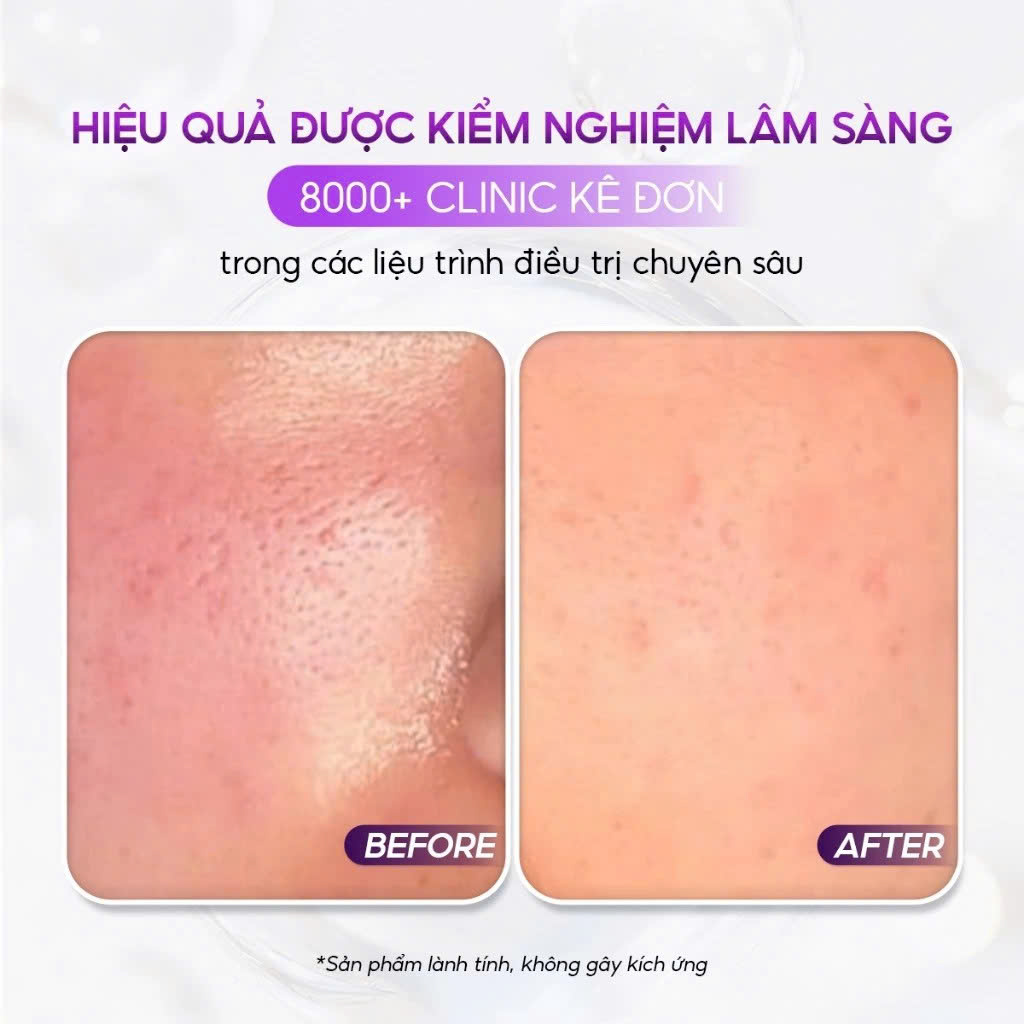 CONAPIDIL FINISH LOTION SPF50+/PA+++: Kem Chống Nắng Chuyên Biệt Cho Làn Da Nhạy Cảm