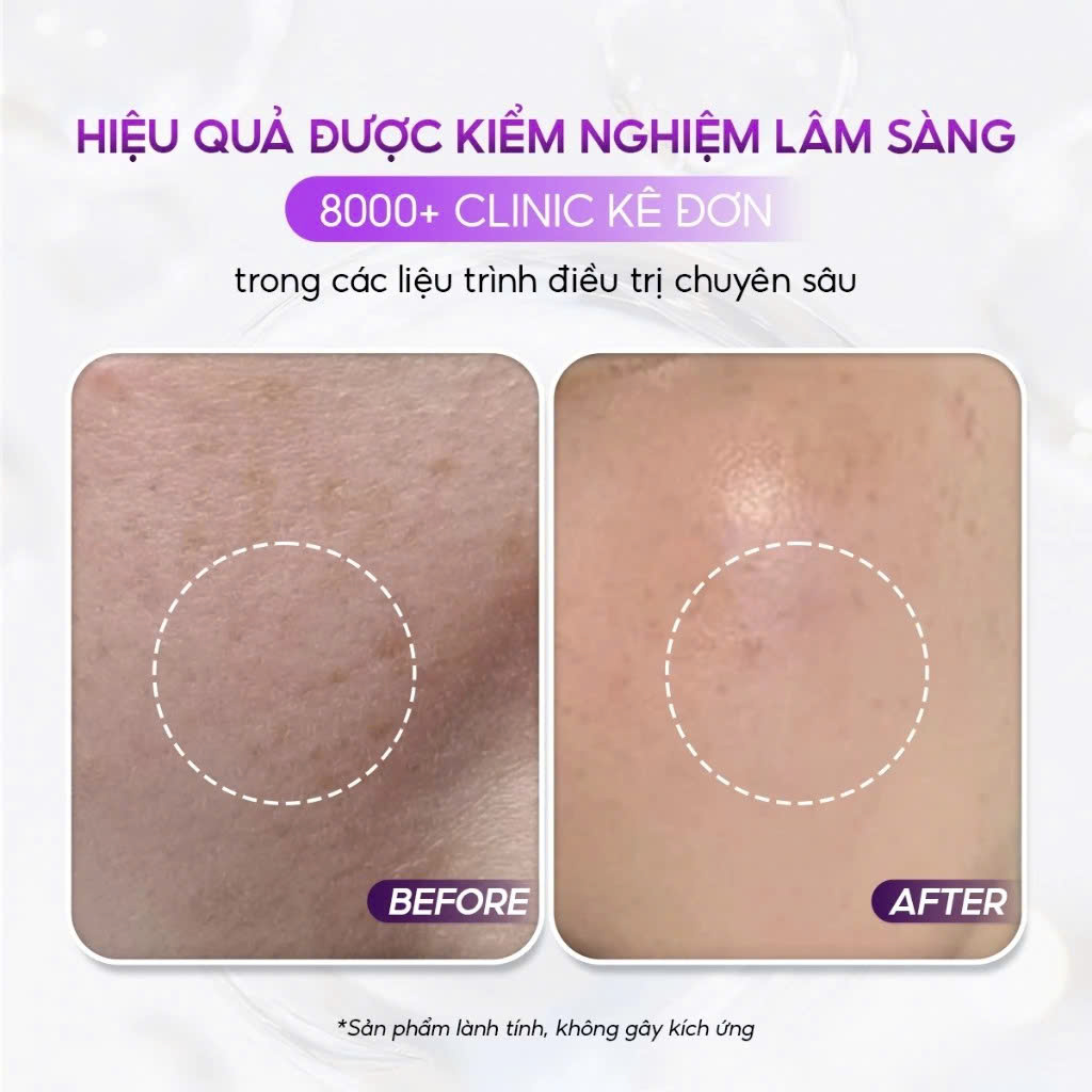 CONAPIDIL FINISH LOTION SPF50+/PA+++: Kem Chống Nắng Chuyên Biệt Cho Làn Da Nhạy Cảm