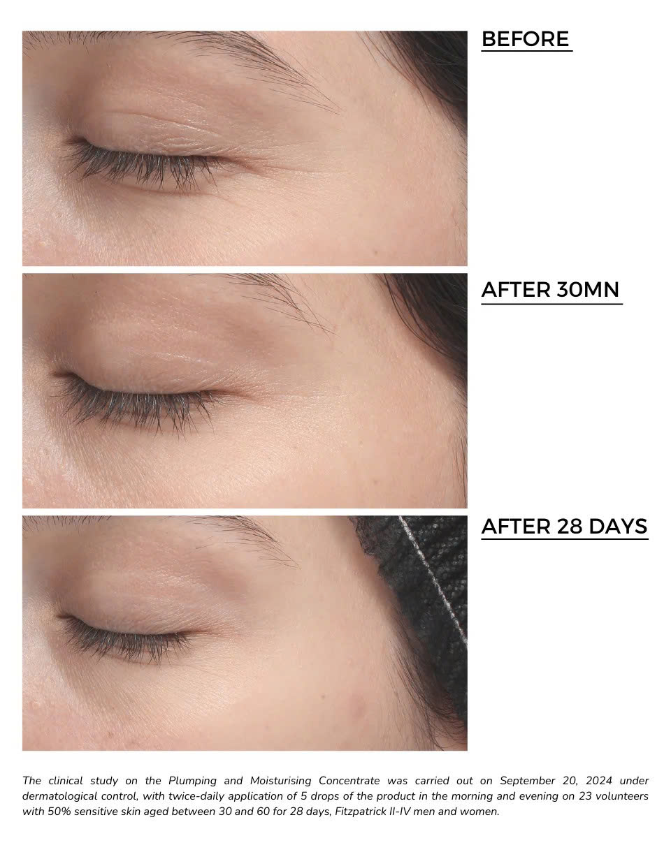 DERMEDEN DERMEDEN HYAL-FILLER PLUMPING AND MOISTURISING CONCENTRATE 15% : Tinh Chất Dưỡng Ẩm Đa Tầng & Hiệu Ứng Làm Đầy Tức Thì