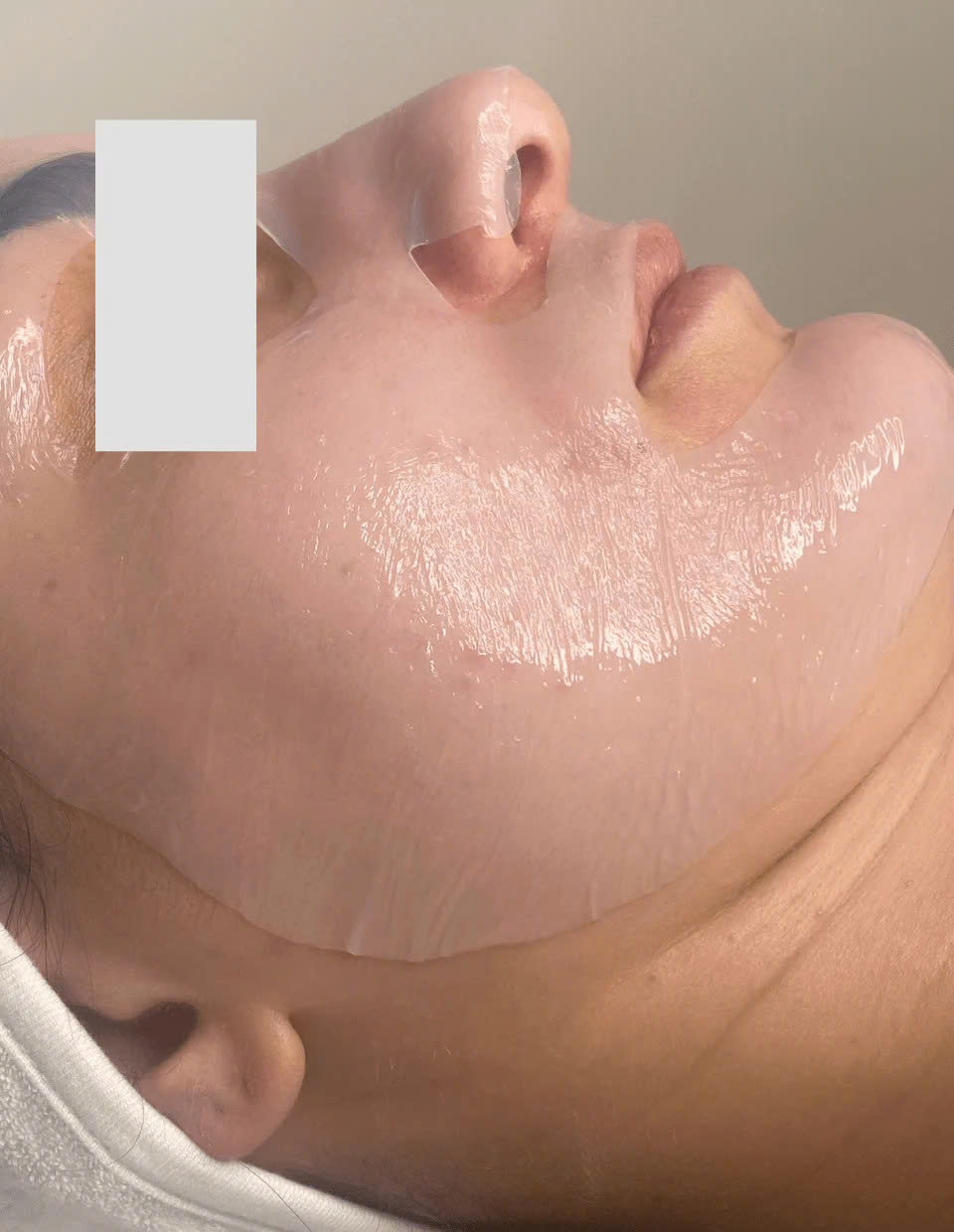 DERMEDEN BIOCELLULOSE: Mặt Nạ Cấp Ẩm & Phục Hồi Chuyên Sâu, Hạn Chế Tăng Sắc Tố Sau Liệu Trình