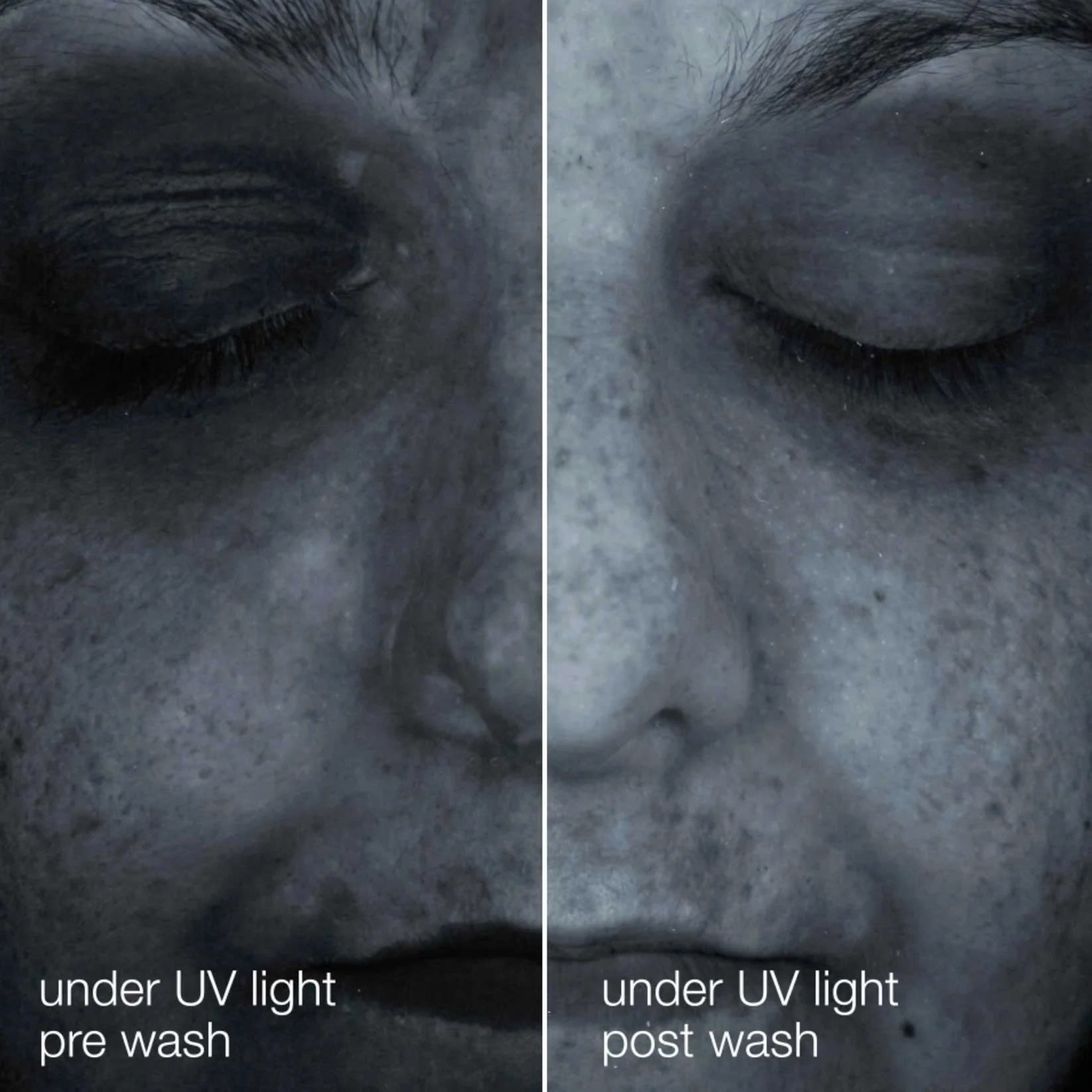 DERMALOGICA OIL TO FOAM TOTAL CLEANSER: Dầu Tẩy Trang & Sữa Rửa Mặt 2-Trong-1, Cho Làn Da Sạch Sâu Hoàn Hảo