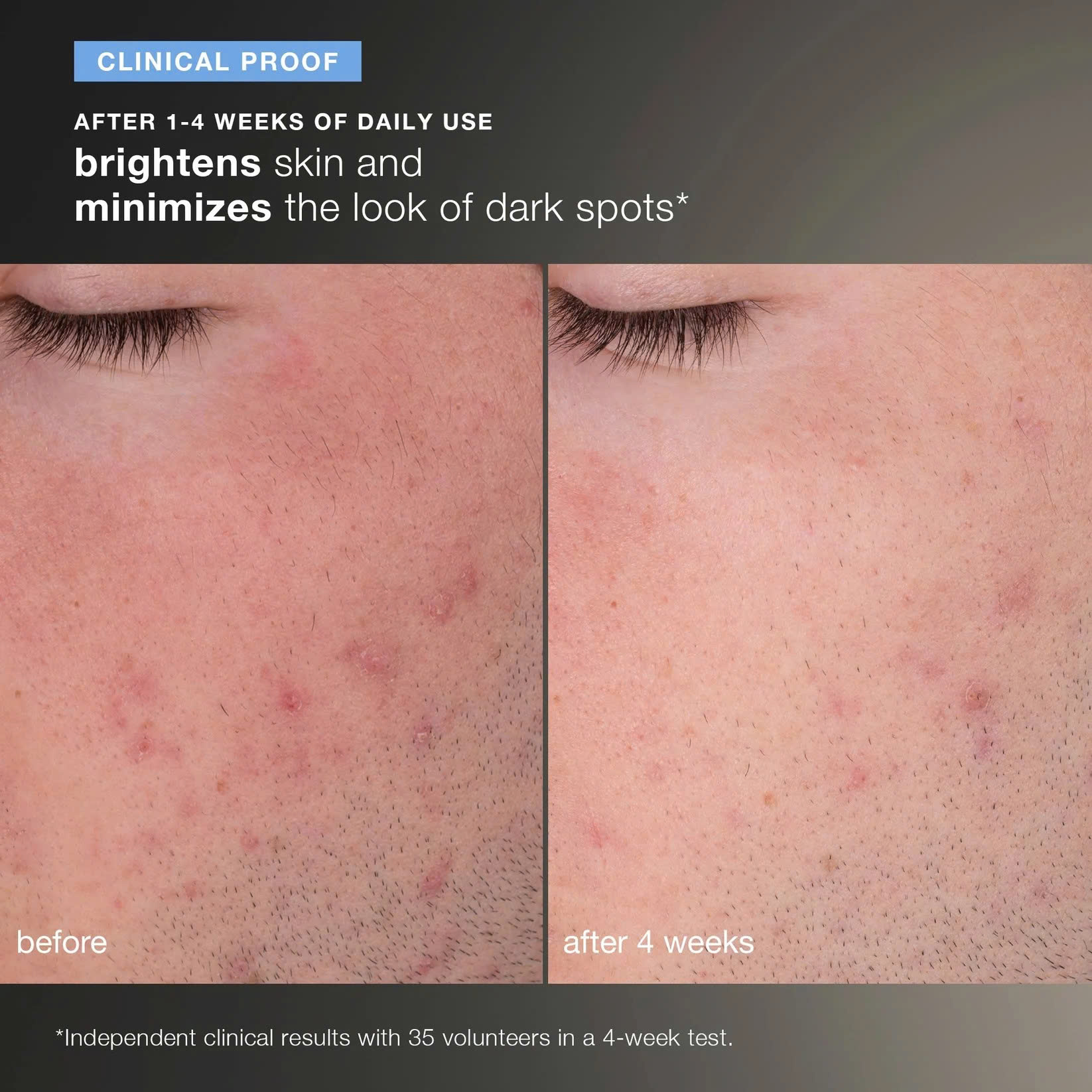 DERMALOGICA DAILY MICROFOLIANT: Tẩy Tế Bào Chết Dạng Bột, Cho Làn Da Sáng Mịn Mỗi Ngày