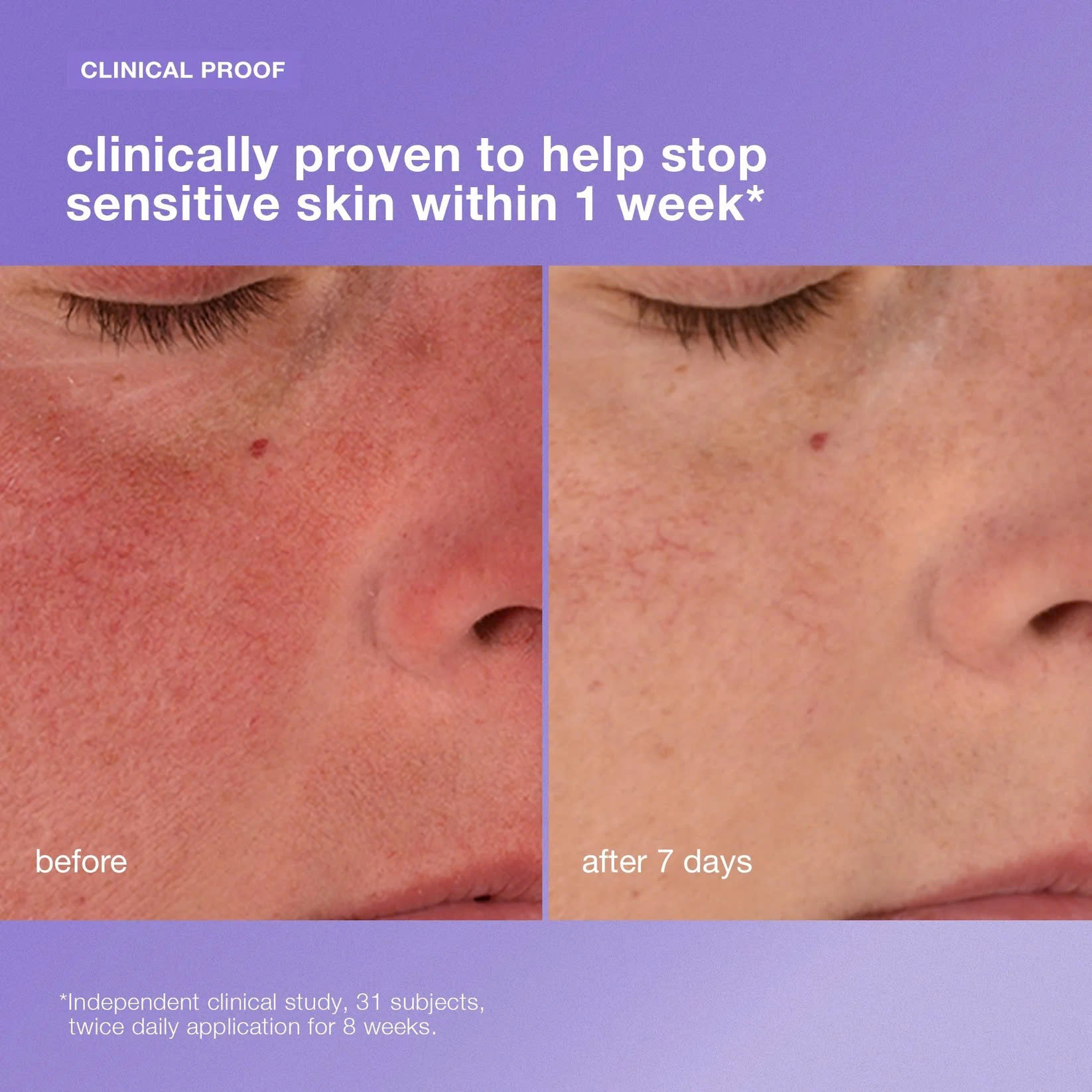 DERMALOGICA STABILIZING REPAIR CREAM: Kem Dưỡng Phục Hồi - Làm Dịu & Tăng Cường Sức Mạnh Làn Da Nhạy Cảm