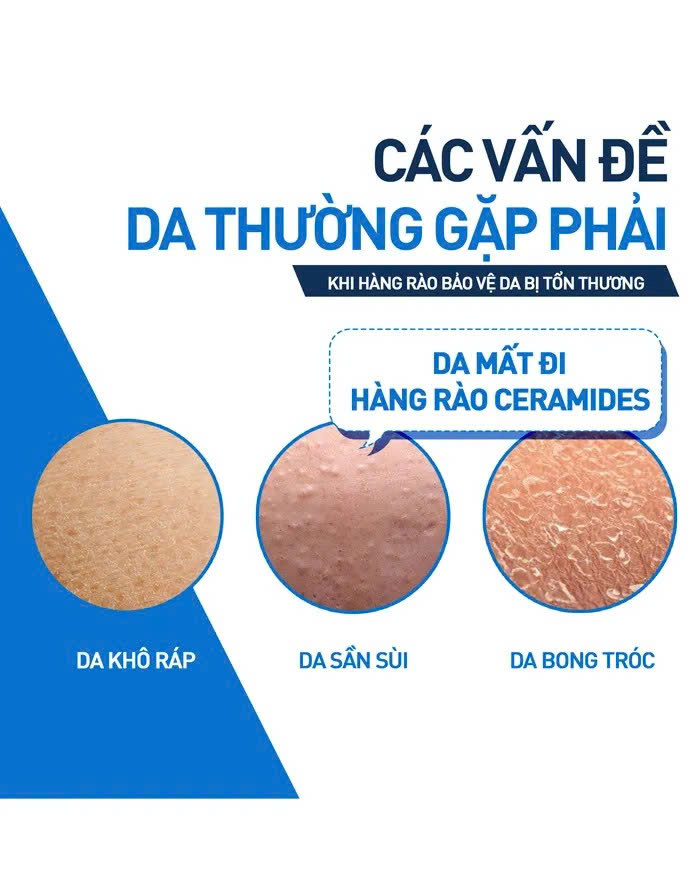 CERAVE MOISTURISING CREAM: Kem Dưỡng Ẩm Toàn Thân Chuyên Sâu, Phục Hồi & Bảo Vệ Da Khô Đến Rất Khô