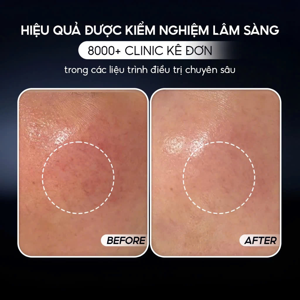 VQM PHYTOCIN (FILM) CREAM: Kem Dưỡng Ẩm Phục Hồi Chuyên Sâu - Kháng Viêm, Giảm Mụn & Tái Tạo Da