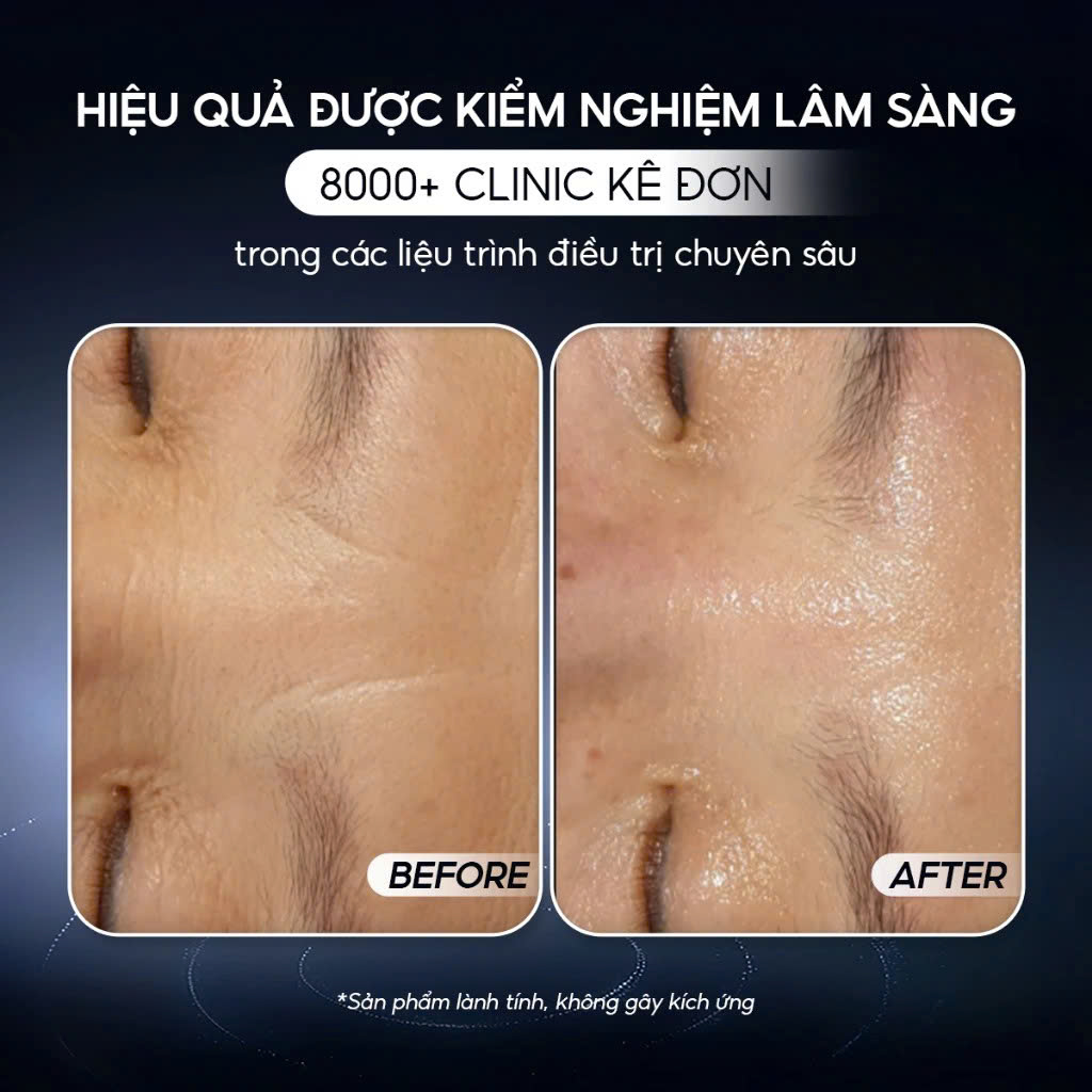 CONAPIDIL CEMENZAL LIGHT (tube) : Kem Dưỡng Hỗ Trợ Tái Tạo & Làm Đầy Sẹo Rỗ - Phục Hồi Chuyên Sâu Từ Tế Bào Gốc