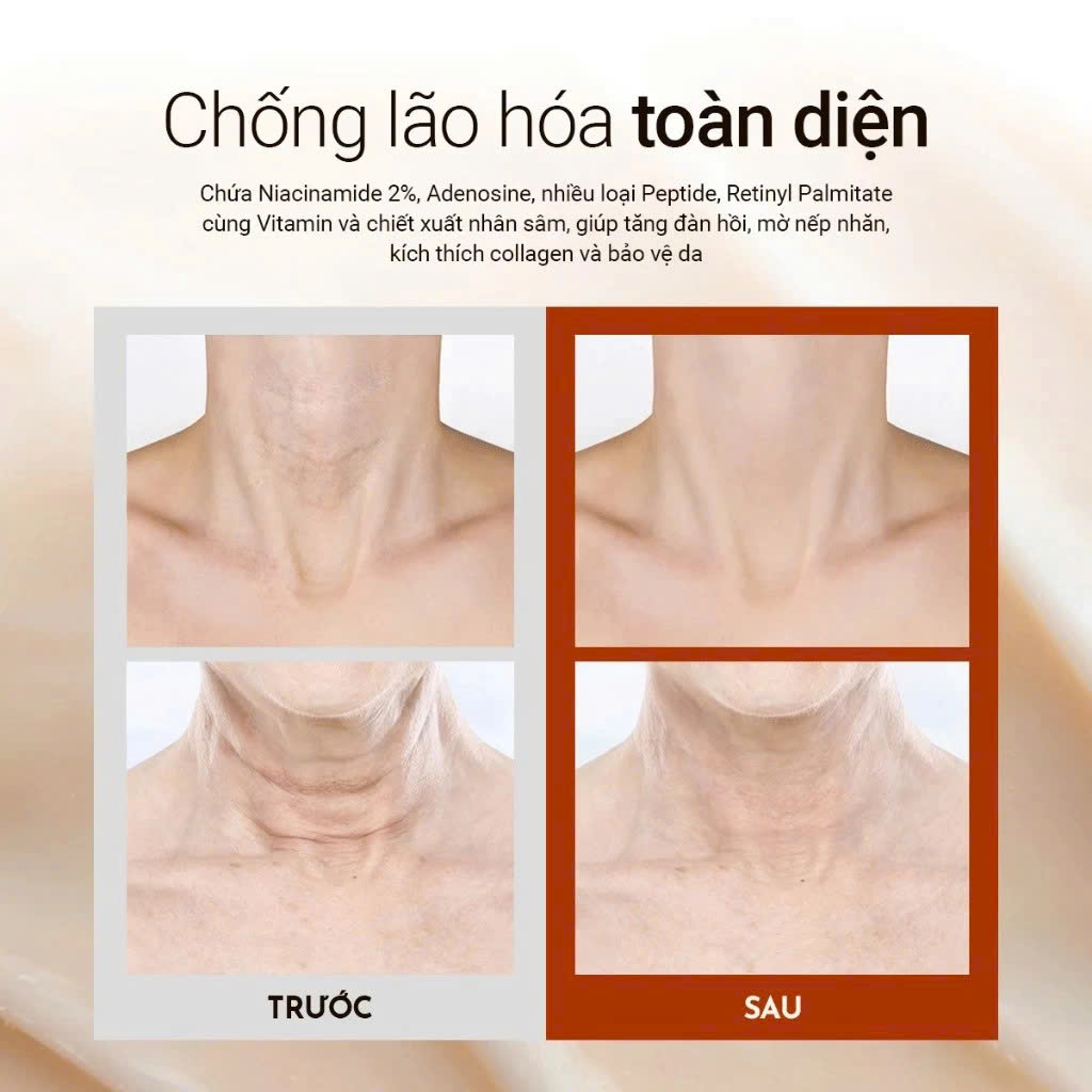 VELLA NECK CREAM ULTIMATE AGE KILLER: Kem Dưỡng Cổ Đa Năng - Giảm Nhăn Sâu & Nâng Cơ, Chống Lão Hóa Toàn Diện