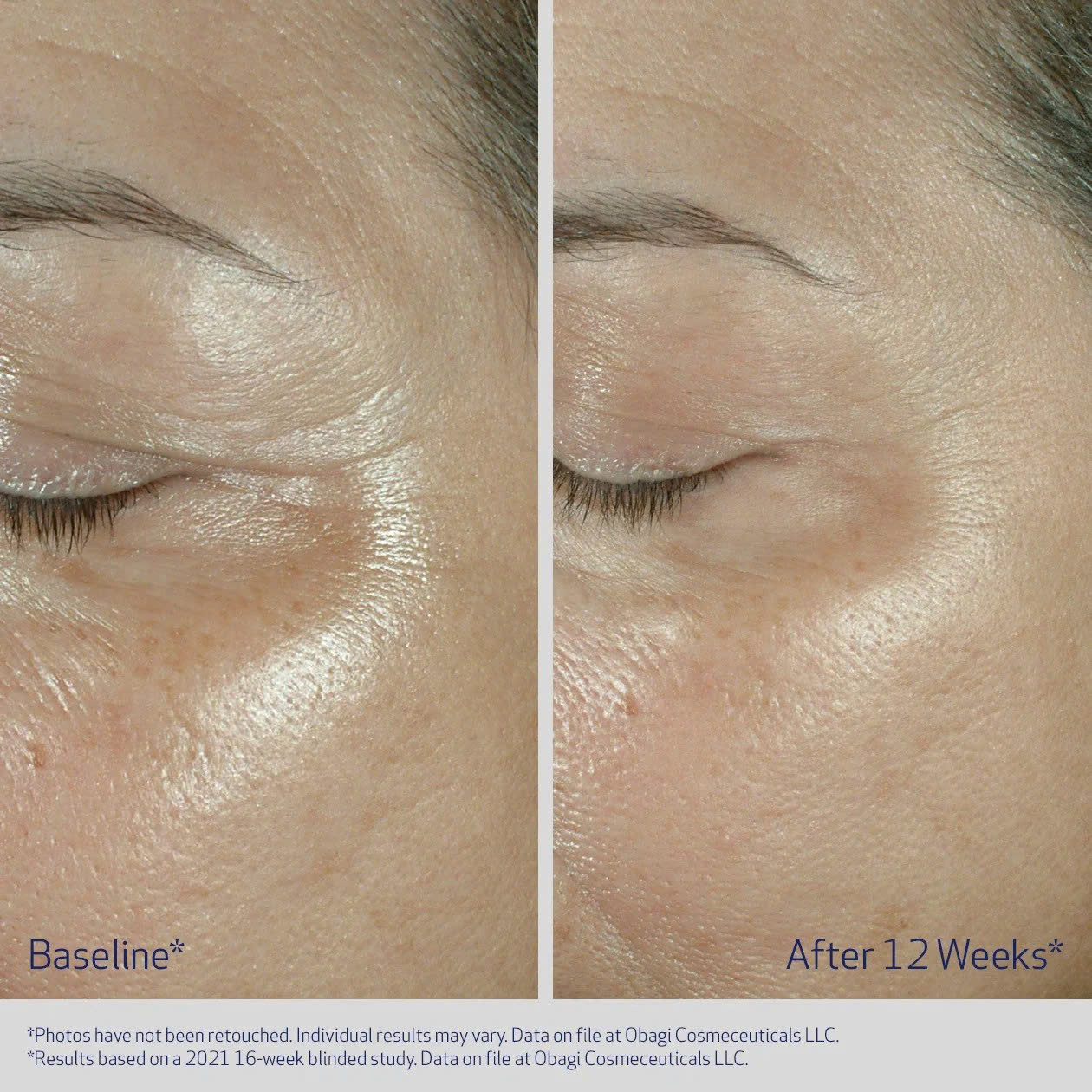 ​​​​​OBAGI ELASTIDERM® FIRMING EYE CREAM: Kem Dưỡng Mắt Tái Tạo Elastin – Đánh Tan Nếp Nhăn, Nâng Cơ & Trẻ Hóa Ánh Nhìn