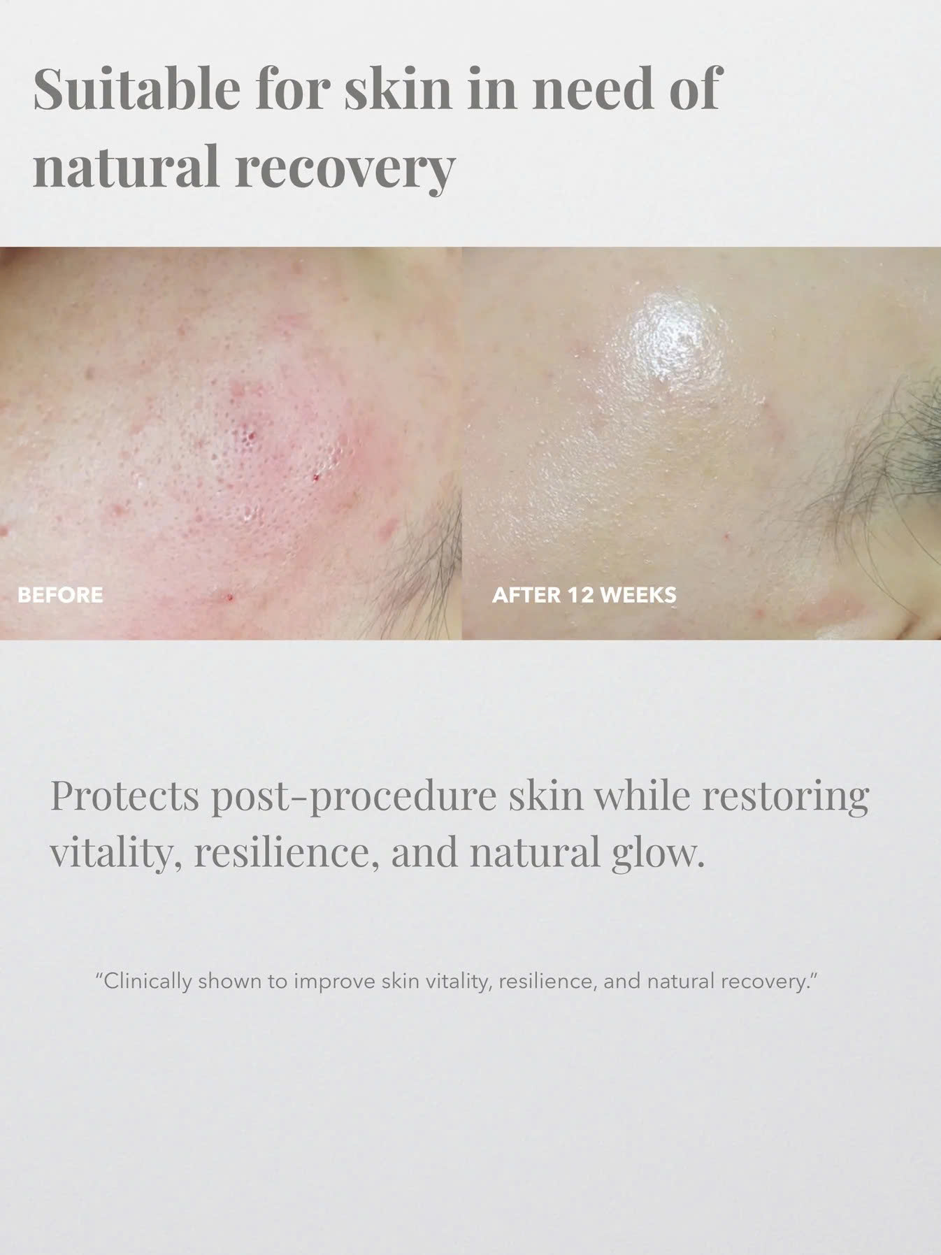 Civasan Sizopirin Cellular Mess Cream – Kem Phục Hồi & Tái Tạo Da Chuyên Sâu 35ml