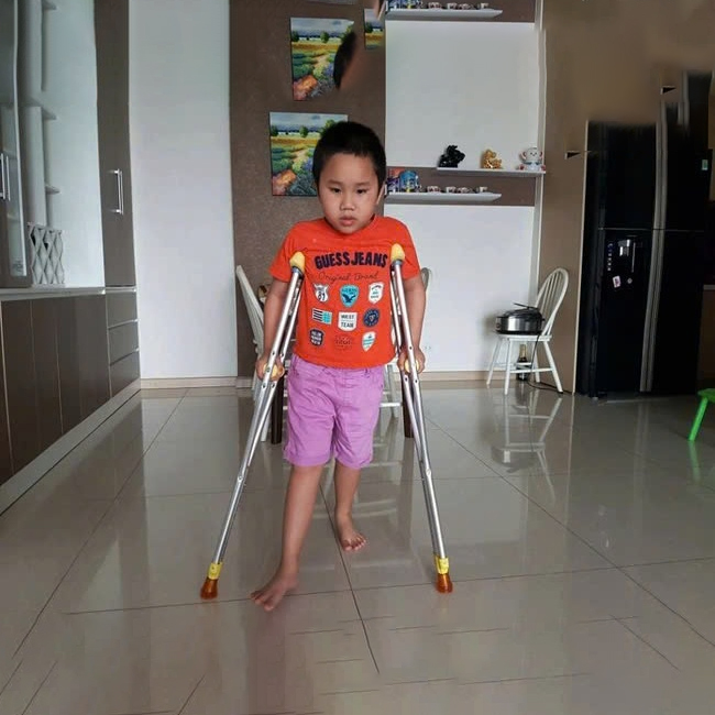 Nạng Trẻ Em Nhôm Lucass C-31 (C31)