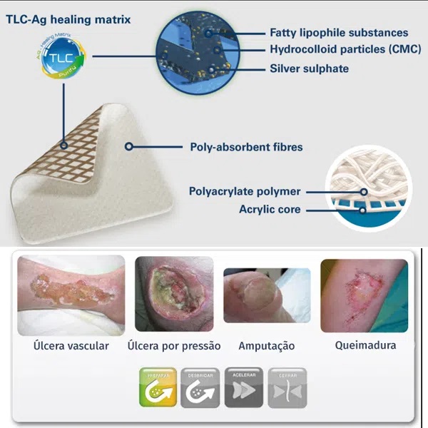 Băng Gạc Chứa Bạc Chống Nhiễm Khuẩn Urgo URGOCLEAN AG