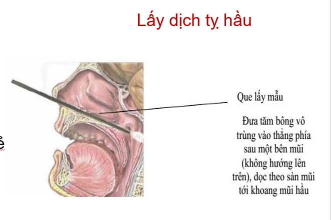 Que Tăm Bông Lấy Dịch Tỵ Hầu Họng Nhiều Thương Hiệu (Tiệt Trùng Từng Que)