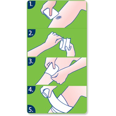 Gạc Lưới Chống Dính Urgo URGOTUL AG/SILVER (Muối Bạc)