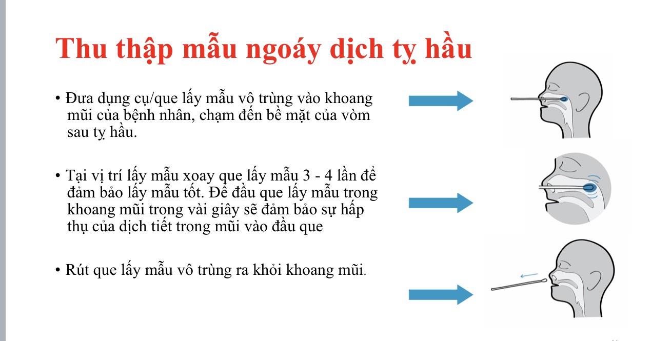Que Tăm Bông Lấy Dịch Tỵ Hầu Họng Nhiều Thương Hiệu (Tiệt Trùng Từng Que)