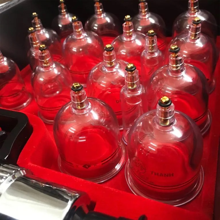 Bộ Giác Hơi Không Dùng Lửa Duy Thành YGH01 (Valy Nâu 17 Ly)