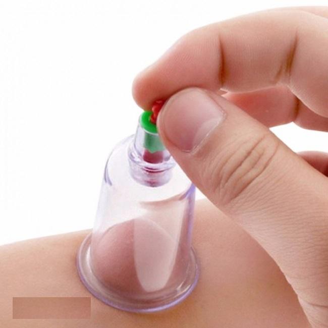 Bộ Giác Hơi Không Dùng Lửa Thái Lan (14 Món Cao Cấp)