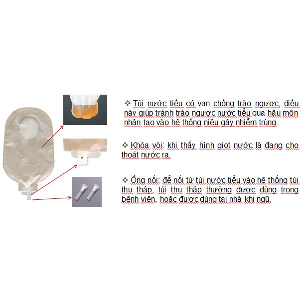 Túi Nước Tiểu Hậu Môn Nhân Tạo 2 Mảnh Hollister 18402 18403 (Van Chống Trào Ngược)