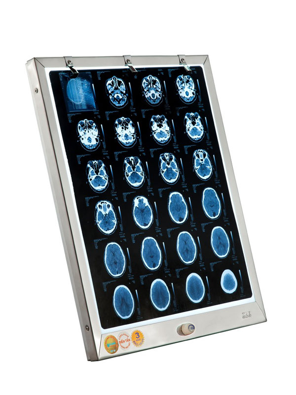 Đèn Đọc Phim Y Khoa LED Thành Nhân TNE