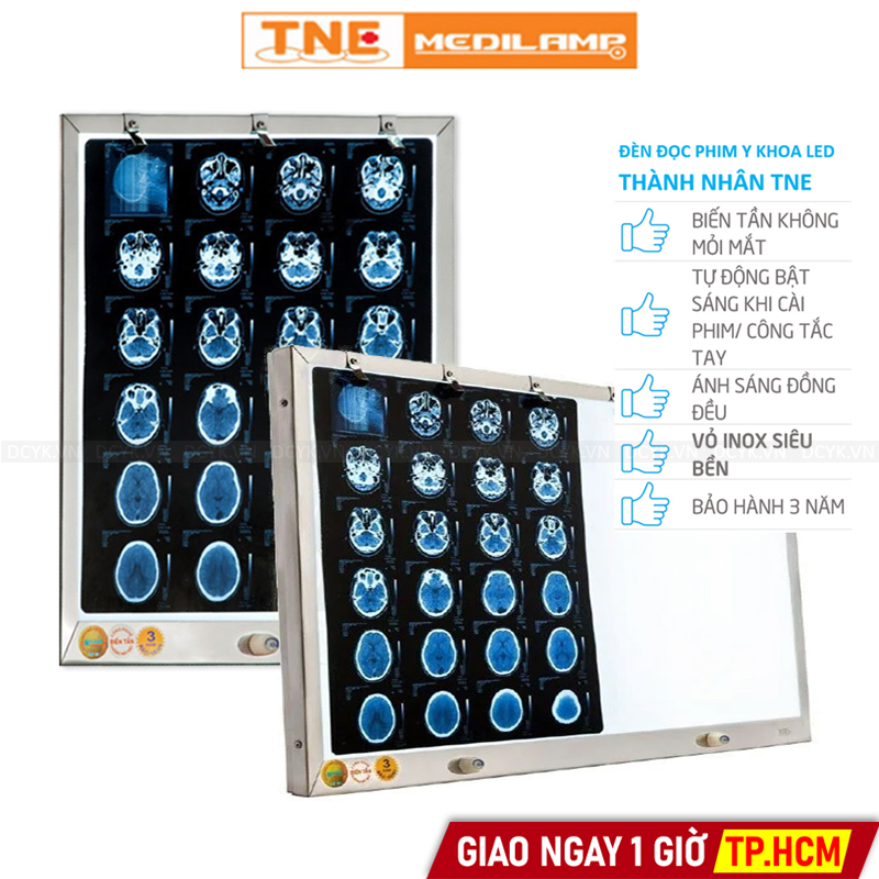 Đèn Đọc Phim Y Khoa LED Thành Nhân TNE