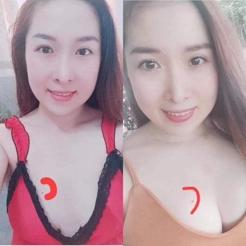 Vòng 1 tăng 4cm sau 1 liệu trình viên mầm sâm tố nữ và kem massage nở ngực Thảo mộc 37 - Xmax Mychi