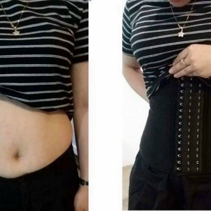 ĐAI NỊT BỤNG 25 XƯƠNG SMOOTH LATEX