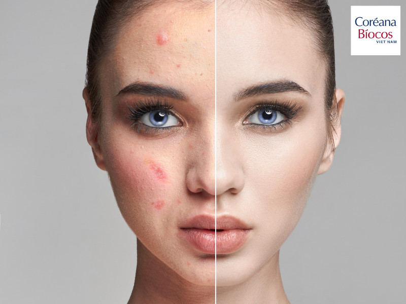 Phân biệt từng loại da và cách xác định loại da của bạn