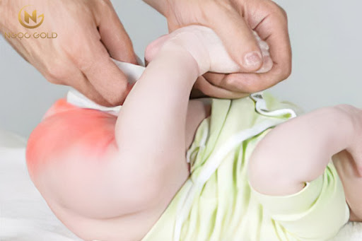 Nguyên nhân, dấu hiệu em bé bị hăm tã và cách chữa trị tại nhà Nguyên nhân, dấu hiệu em bé bị hăm tã và cách chữa trị tại nhà