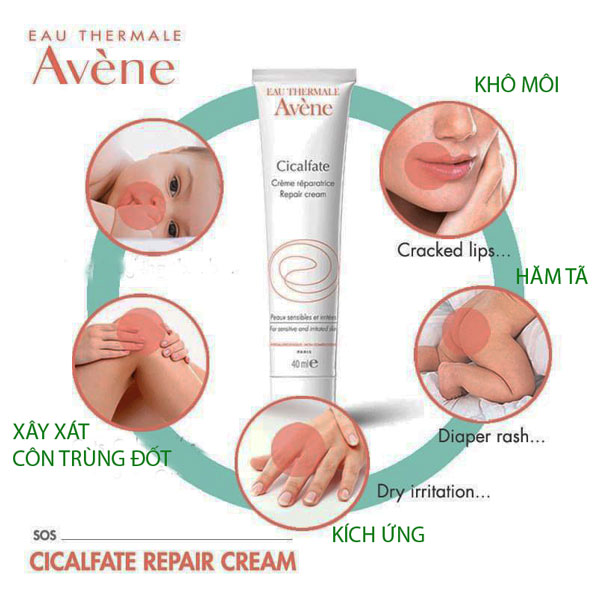 Kem Dưỡng Phục Hồi Da Avène Cicalfate Restorative Skin Cream