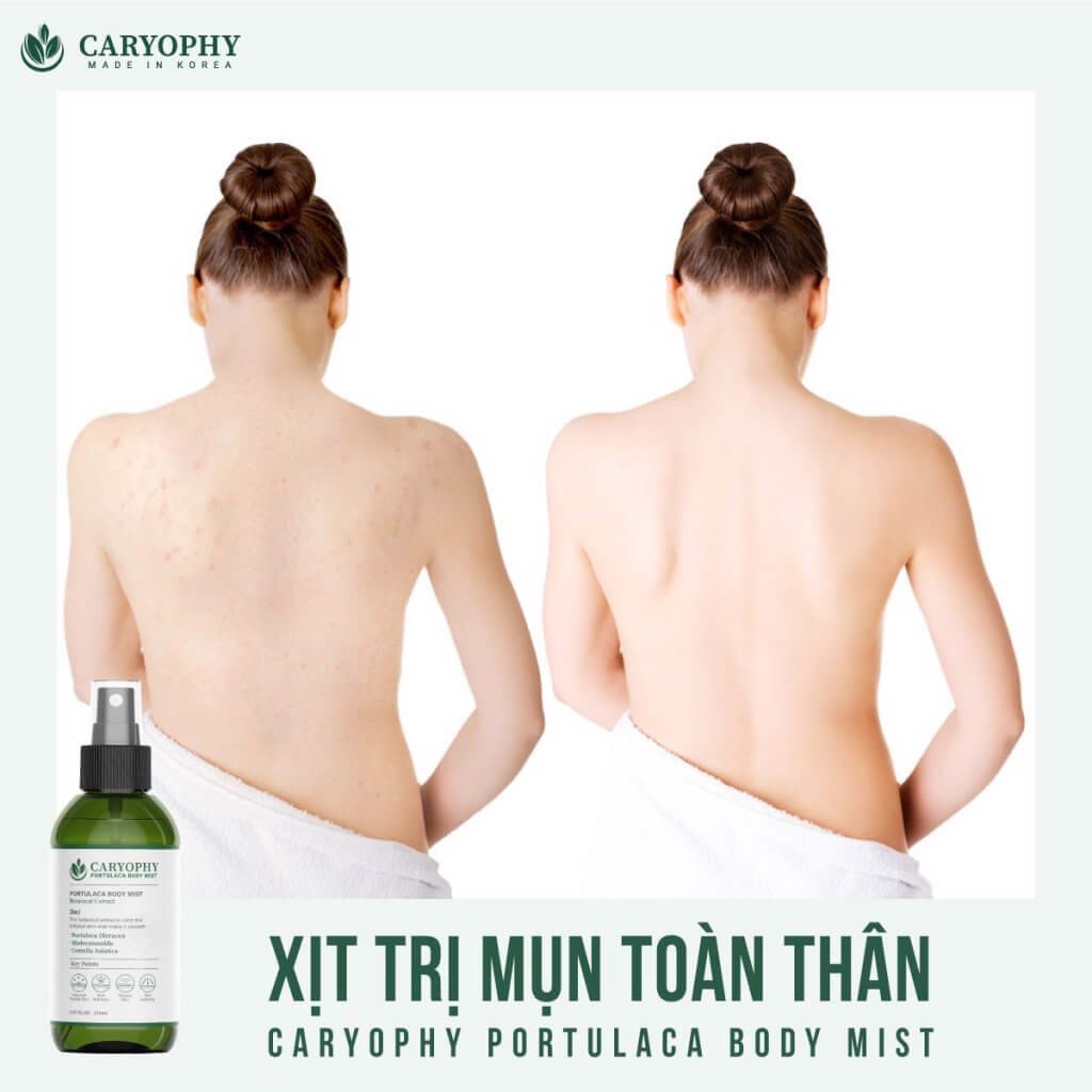 Xịt Giảm Mụn Toàn Thân Caryophy Portulaca Body Mist