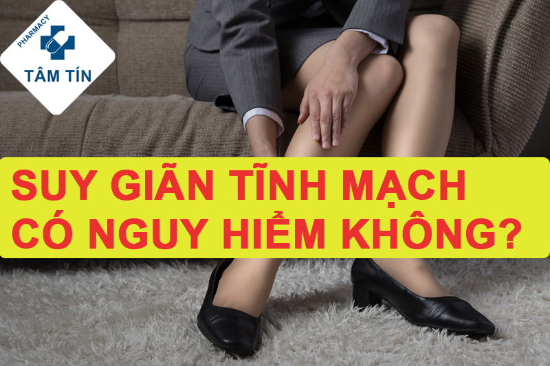 Suy Giãn Tĩnh Mạch Có Nguy Hiểm Không?