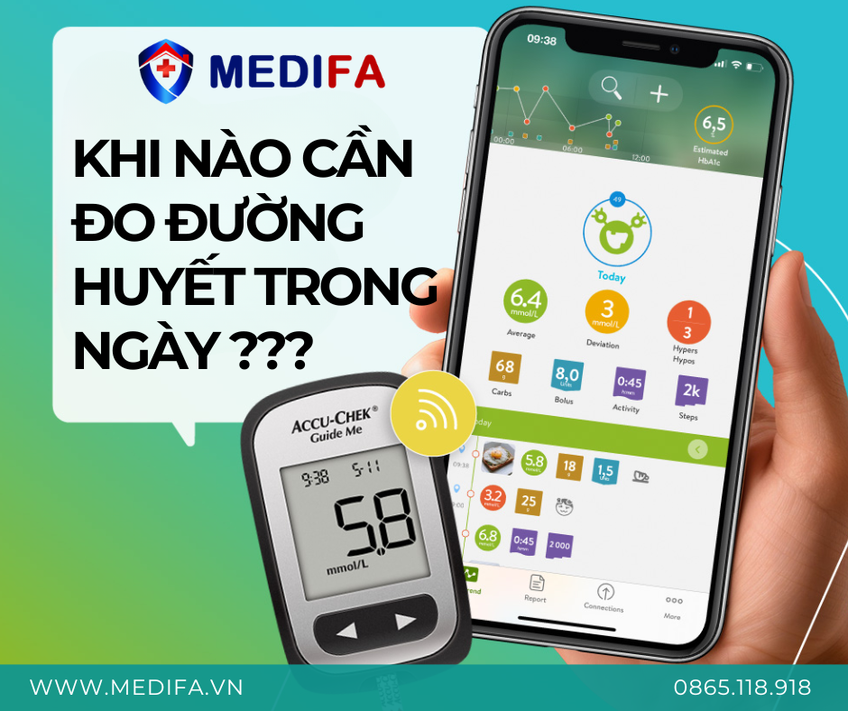 Khi Nào Nên Đo Đường Huyết Trong Ngày? Thời Điểm Đo Chuẩn Bác Sĩ Khuyên