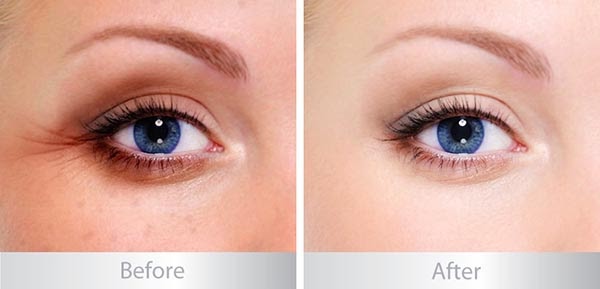 IMAGE AGELESS TOTAL EYE LIFT CREME - Kem chống nắng vùng nắng