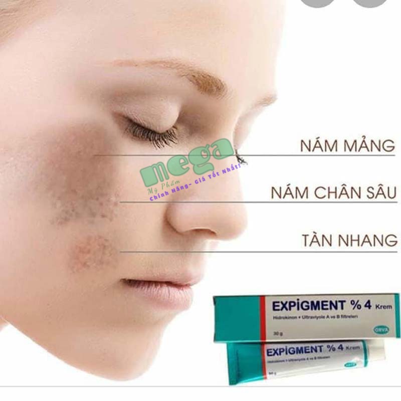 Kem Trị Nám Theo Vùng Expigment 4%