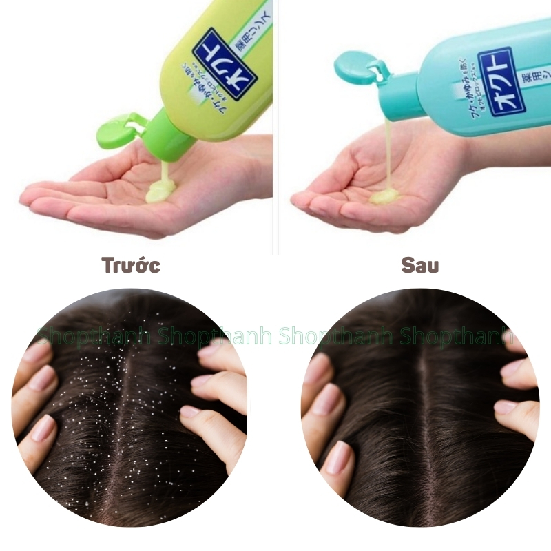 Dầu Gội Xả Lion Octo 320ml Nhật Bản - Giải Pháp Chăm Sóc Da Đầu Khỏe Mượt, Ngừa Gàu Ngứa Hiệu Quả