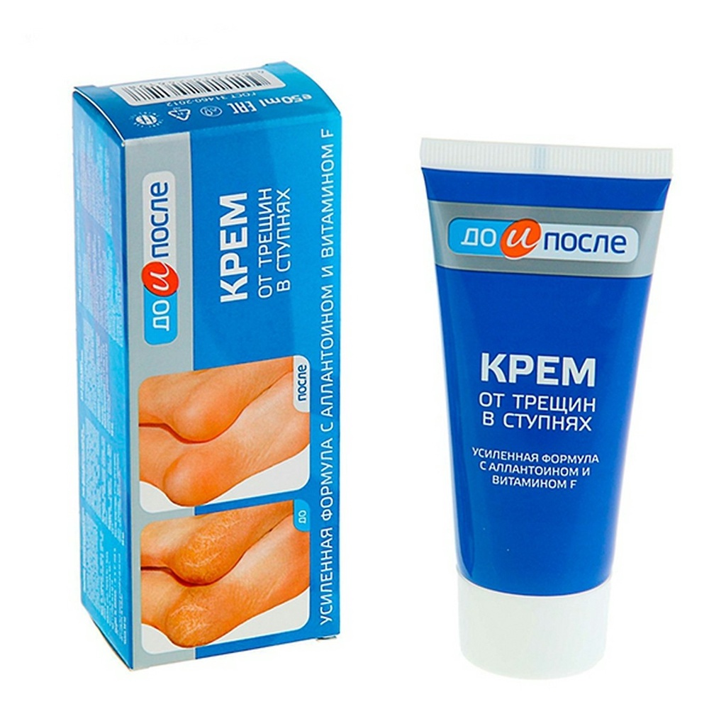 Kem Hỗ Trợ Cải Thiện Nứt Gót Chân Kpem Apteka 50ml Nga