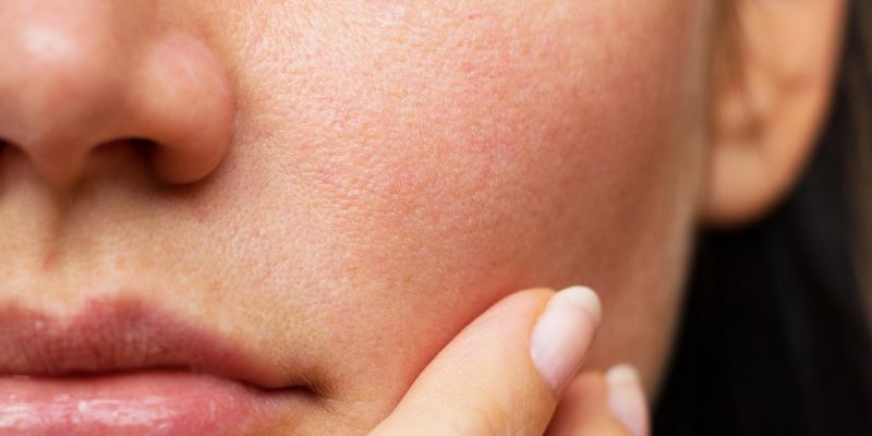 Bắt mạch làn da và bí quyết lựa chọn kem dưỡng ẩm phù hợp