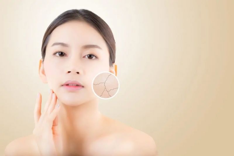 Bắt mạch làn da và bí quyết lựa chọn kem dưỡng ẩm phù hợp
