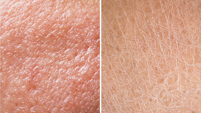 Da hỗn hợp cần được chăm sóc đặc biệt và lâu dài để giữ cho nó khỏe mạnh và rạng rỡ.