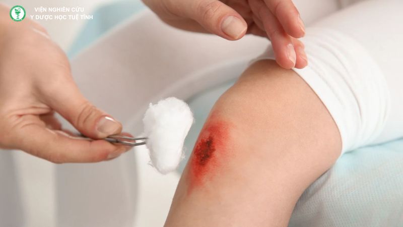 Khí có khả năng nhiếp huyết (cầm máu)