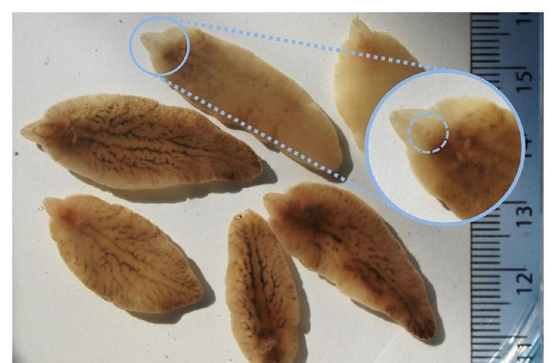 Sán Lá Gan: Bệnh Nguy Hiểm Từ Thói Quen Ăn Uống – Dấu Hiệu Nhận Biết và Cách Điều Trị