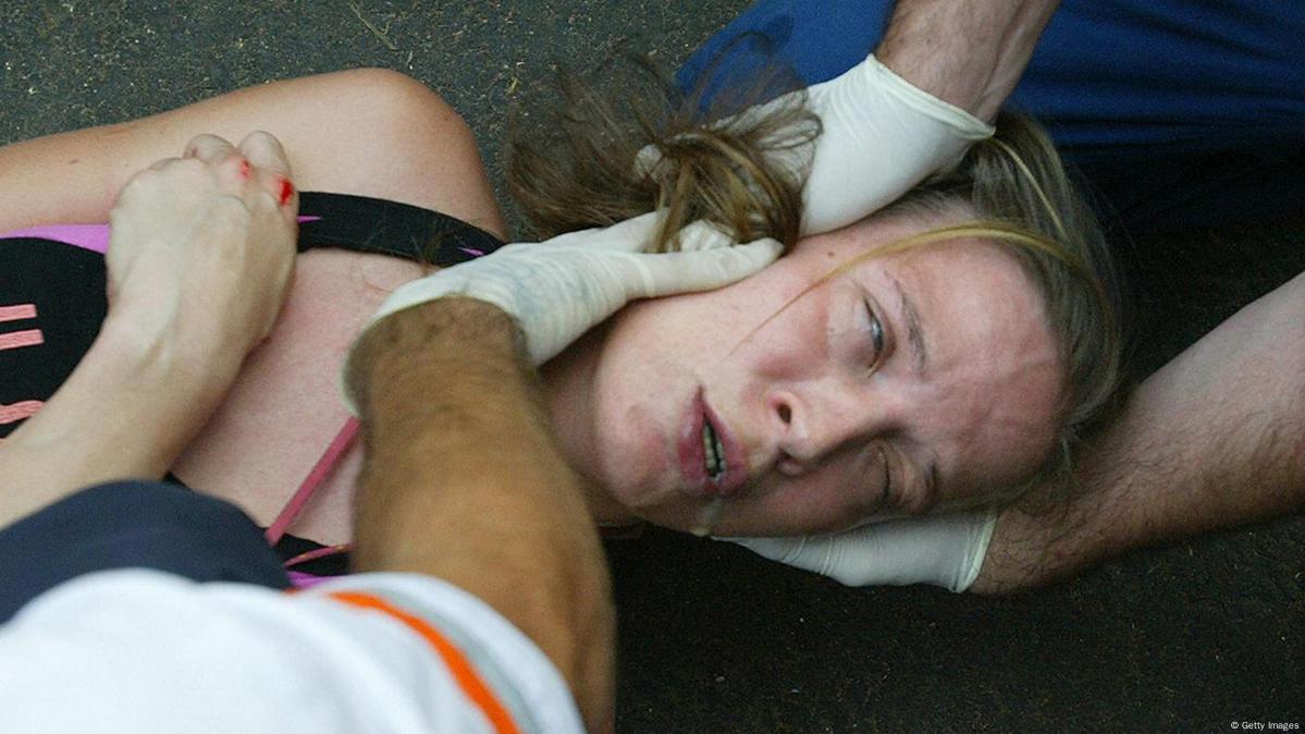 Bệnh động kinh: Hiểu đúng để kiểm soát hiệu quả