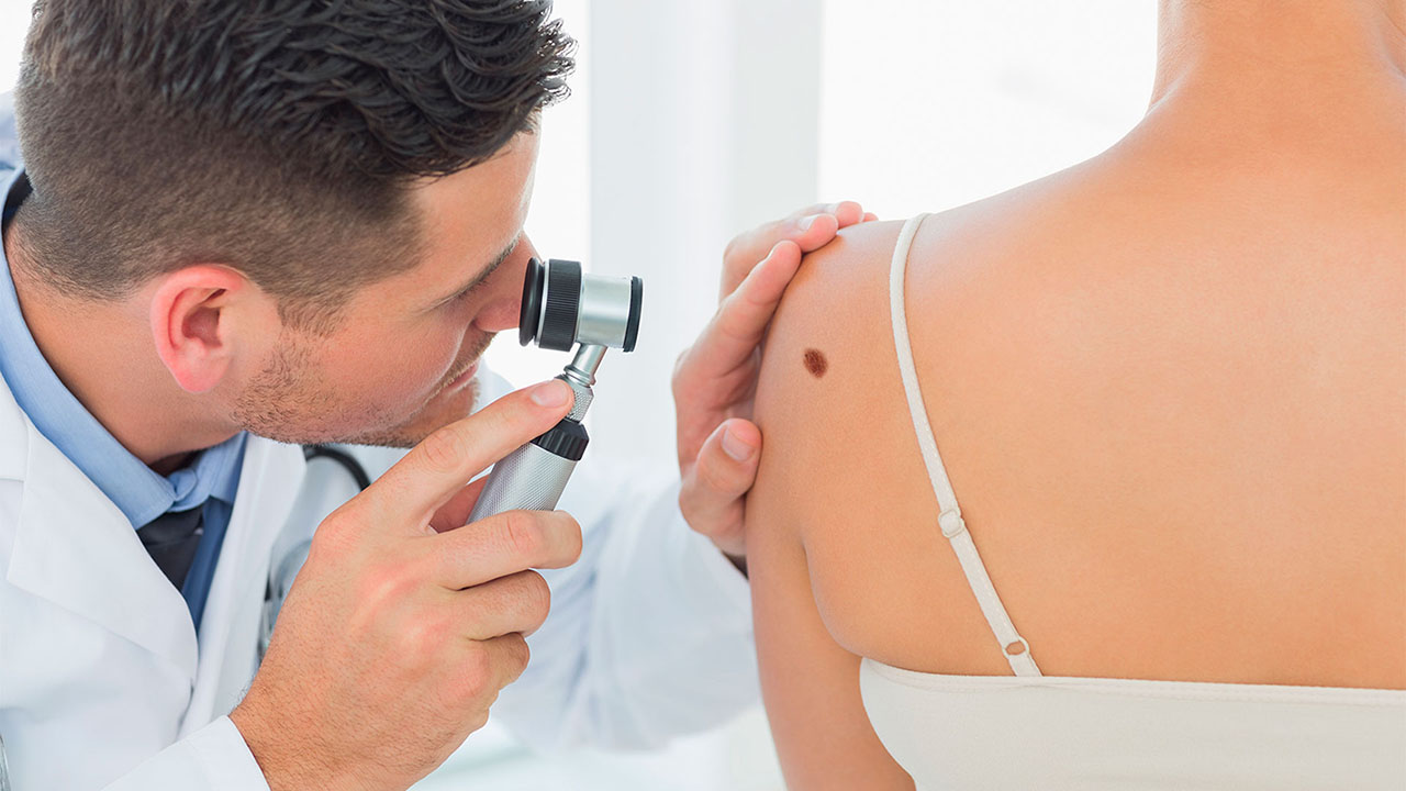 Nốt ruồi, vết bớt và nốt sắc tố dưới góc nhìn y khoa: Khi nào cần cảnh giác?
