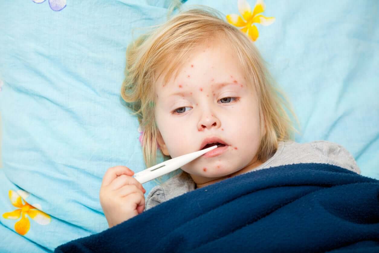 Bệnh sởi: Nguyên nhân, triệu chứng, cách phòng ngừa và điều trị hiệu quả
