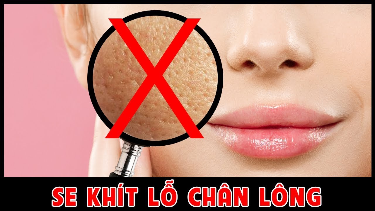 Lỗ chân lông to là gì? Nguyên nhân, cách cải thiện và chăm sóc da hiệu quả